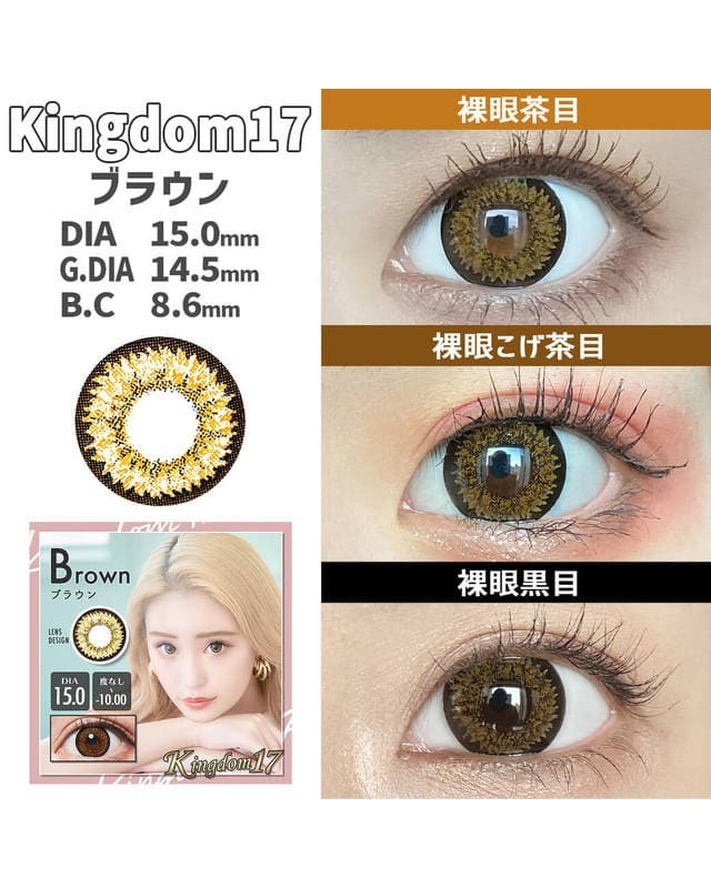 上品な キングダム17 [Kingdom 17] DIA15.0mm 最長1年【2枚(1箱1枚ずつ その他